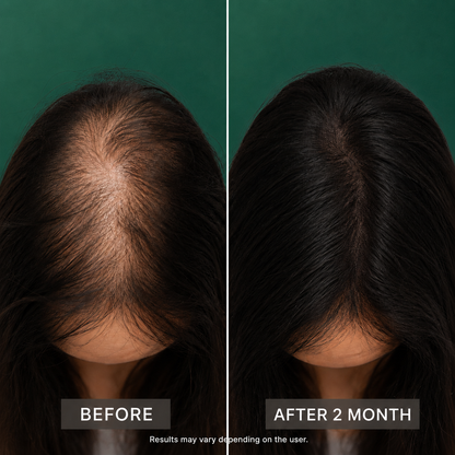 Hair Growth Oil